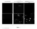 Fig. 02 - Methods and pharmaceutical compositions for expressing a polynucleotide of interest in the peripheral nervous system of a subject