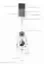 Fig. 04 - Method of detecting genetic material in a biological sample and a device for its implementation