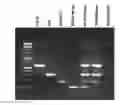 Fig. 01 - Method and kit for determining the genome integrity and/or the quality of a library of DNA sequences obtained by deterministic restriction site whole genome amplification