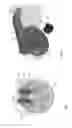 Fig. 05 - Mechanism for a lockset and a method for configuring a lockset's function