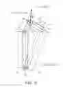 Fig. 09 - VIBRATION DAMPING DEVICE