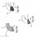 Fig. 08 - Oil quieting direction control baffle