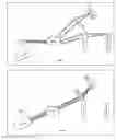 Fig. 02 - Method and apparatus for combining measurements of particle characteristics using light scattering and optical imaging