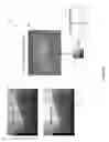 Fig. 07 - Dual-energy microfocus radiographic imaging method for meat inspection