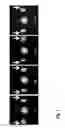 Fig. 03 - Field of view increase in magnetic resonance imaging using nonlinear gradients and generalized iterative reconstruction