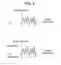 Fig. 04 - Seismic sensor and earthquake determination method