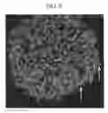 Fig. 06 - Microscope parameter setting method and observation method recognizing the shape of a cell
