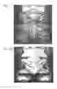 Fig. 06 - Method and apparatus for maintaining the surface of a reticle free of particles