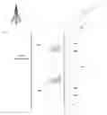 Fig. 01 - Varying the distance between vehicles in a platoon