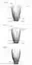 Fig. 06 - Designing a dental restoration