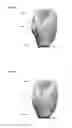 Fig. 09 - Designing a dental restoration