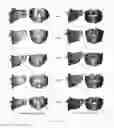 Fig. 33 - PRODUCING A THREE-DIMENSIONAL MODEL OF AN IMPLANT