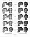 Fig. 34 - PRODUCING A THREE-DIMENSIONAL MODEL OF AN IMPLANT