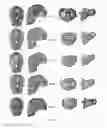 Fig. 50 - PRODUCING A THREE-DIMENSIONAL MODEL OF AN IMPLANT