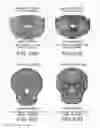 Fig. 51 - PRODUCING A THREE-DIMENSIONAL MODEL OF AN IMPLANT
