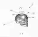 Fig. 53 - PRODUCING A THREE-DIMENSIONAL MODEL OF AN IMPLANT