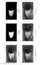 Fig. 09 - Feature extraction and matching for biometric authentication