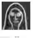 Fig. 06 - Accelerated skin smoothing effect
