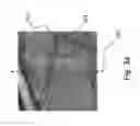 Fig. 05 - Method and apparatus for detecting defects on the surface of tyres