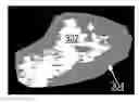 Fig. 01 - Systems and methods for prediction of tumor response to chemotherapy using pre-treatment quantitative ultrasound parameters