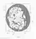 Fig. 04 - Measuring intramuscular fat