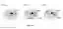 Fig. 14 - Systems and methods for image segmentation
