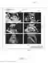 Fig. 02 - SYSTEMS AND METHODS FOR GENERATING AN ULTRASOUND MULTIMEDIA PRODUCT