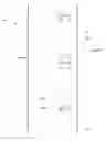 Fig. 01 - Detection of extra-platoon vehicle intermediate or adjacent to platoon member vehicles