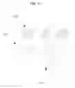 Fig. 10 - BUTTON HAVING VARIABLE BRAILLE MODULES