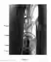 Fig. 12 - Label for decorating a bottle, bottle and method of manufacture of such a label