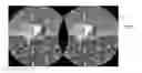 Fig. 01 - Compression of distorted images for head-mounted display
