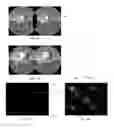 Fig. 02 - Compression of distorted images for head-mounted display