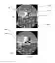 Fig. 04 - Compression of distorted images for head-mounted display