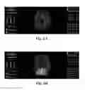 Fig. 07 - System and method for modifying biometric activity using virtual reality therapy