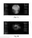 Fig. 08 - System and method for modifying biometric activity using virtual reality therapy
