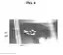 Fig. 05 - DYE SENSITIZED SOLAR CELL MODULE AND DYE SENSITIZED SOLAR CELL COMPRISING THE SAME