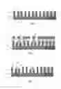 Fig. 02 - Structure with local contact for shorting a gate electrode to a source/drain region