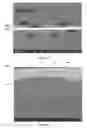 Fig. 04 - Ultrasonic Transmitter and Receiver