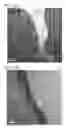 Fig. 16 - Negative electrode for power storage device and power storage device