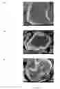 Fig. 09 - Cobalt-based lithium metal oxide cathode material