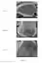 Fig. 13 - Cobalt-based lithium metal oxide cathode material