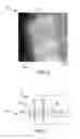 Fig. 04 - Magnesium metal devices and methods of making the same