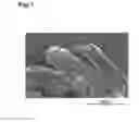 Fig. 02 - Active material, method of manufacturing active material, and lithium-ion secondary battery