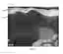Fig. 02 - Annealed garnet electrolyte separators