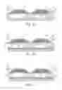 Fig. 08 - Bulk acoustic wave filter and a method of frequency tuning for bulk acoustic wave resonator of bulk acoustic wave filter