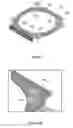 Fig. 04 - Bearing limiter structures in optical image stabilization suspensions