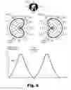 Fig. 09 - Binaural hearing systems and methods for preserving an interaural level difference to a distinct degree for each ear of a user