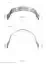 Fig. 35 - PLASTIC HELMET MOUNTING ASSEMBLY