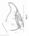 Fig. 03 - Energy return orthotic systems
