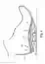 Fig. 04 - Energy return orthotic systems